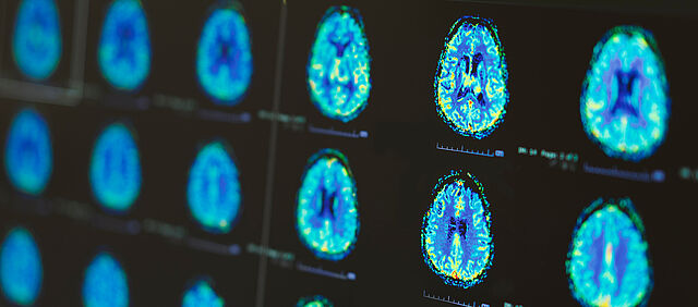 Neurologische Notfälle